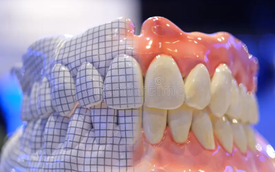 caso-protesis-total_2